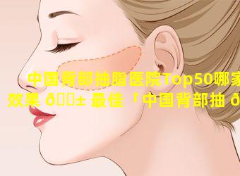 中国背部抽脂医院Top50哪家效果 🐱 最佳「中国背部抽 🕊 脂医院top50哪家效果最佳」